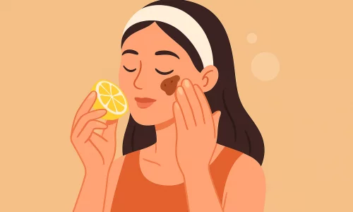 Yuzdagi Dog‘larni Ketkazish